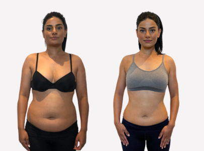 Client Before After Body Transformation Image